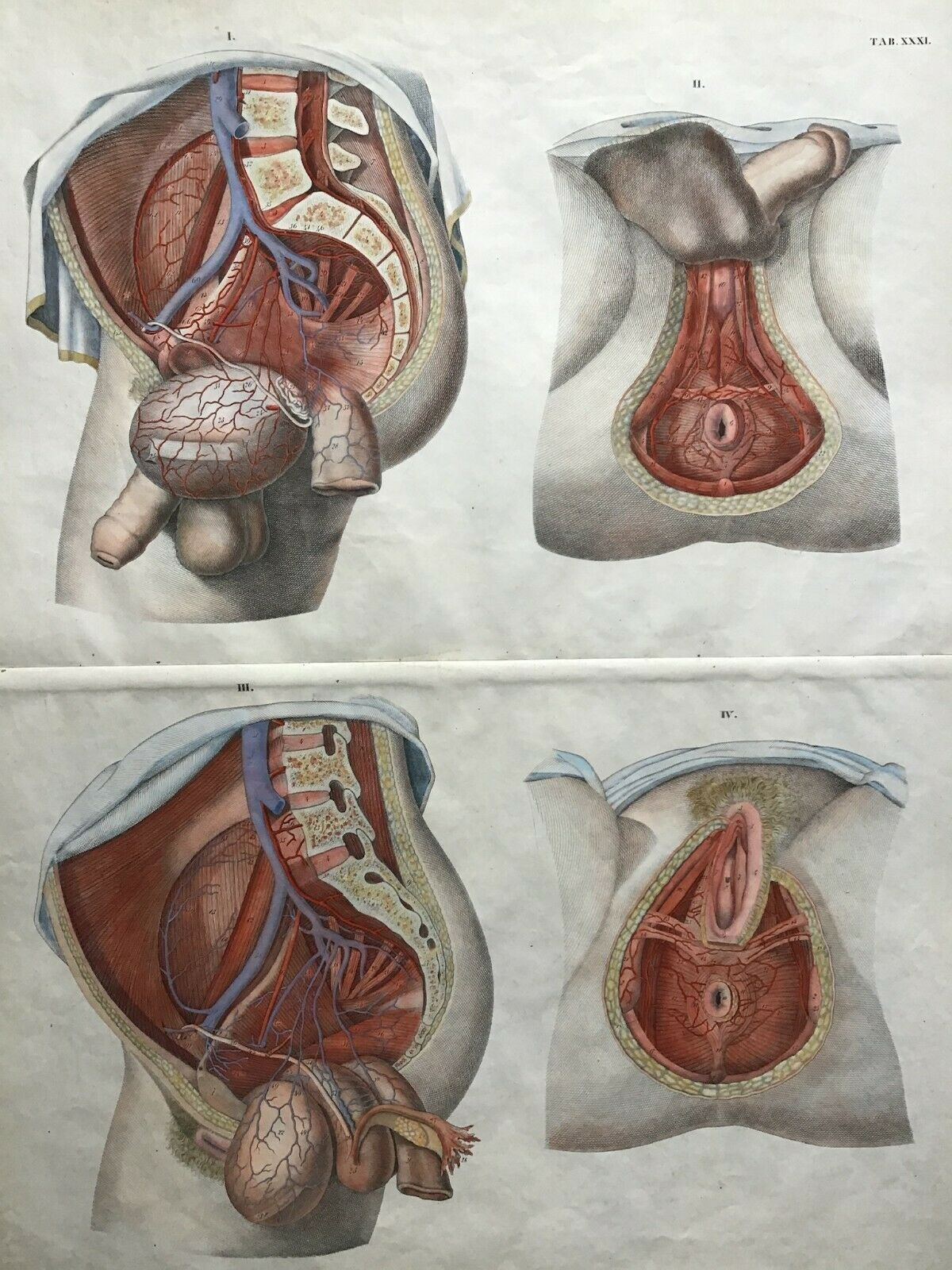 ANATOMIE - WEBER - Dusseldorf -1830 - artère iliaque chez l'homme