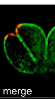 Toxoplasma_Beck.PNG