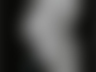 OSTEOCHONDROSES DE CROISSANCE: Maladie de Sever, Osgood-Sclatter...