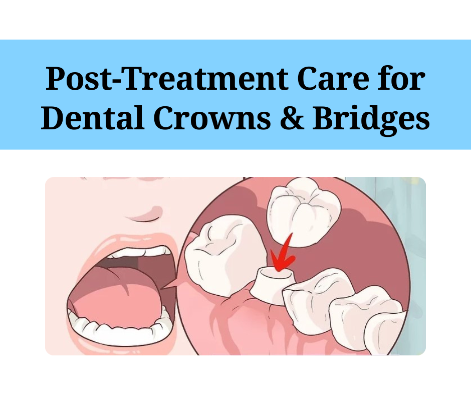 Post treatment care image
