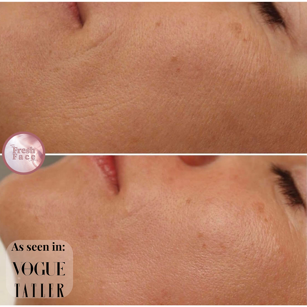 Thumbnail: The Natural Face Lift Course