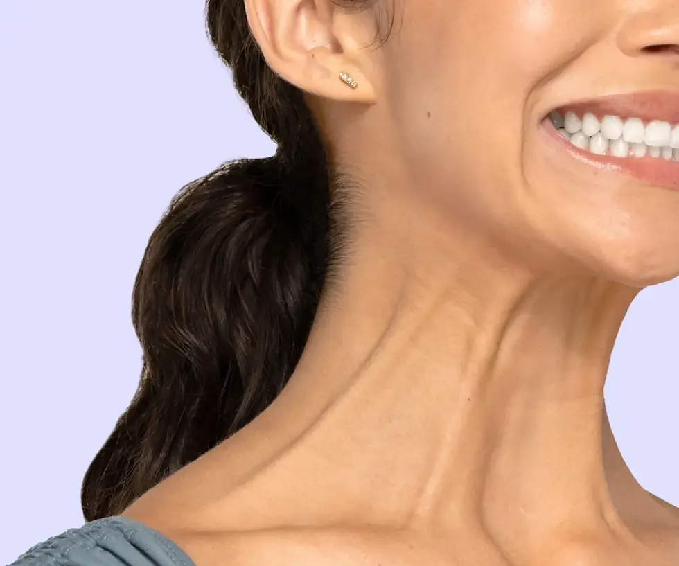 Platysma neck muscles