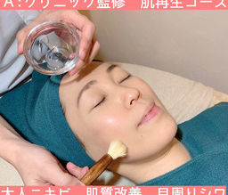 まさに！どの女性にも欠かせない美肌ケア♡とは！？美容皮膚科監修【ケミカルピーリング】