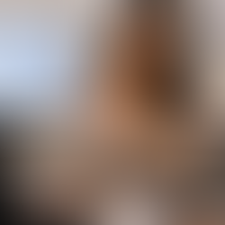 Woman considering breast augmentation surgery