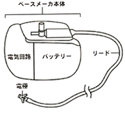 pacemaker4.gif