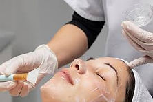 peelings quimicos medicos.jpg