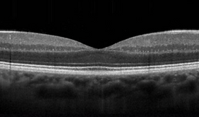 Captura de Tela 2024-10-24 às 05.56.20.png