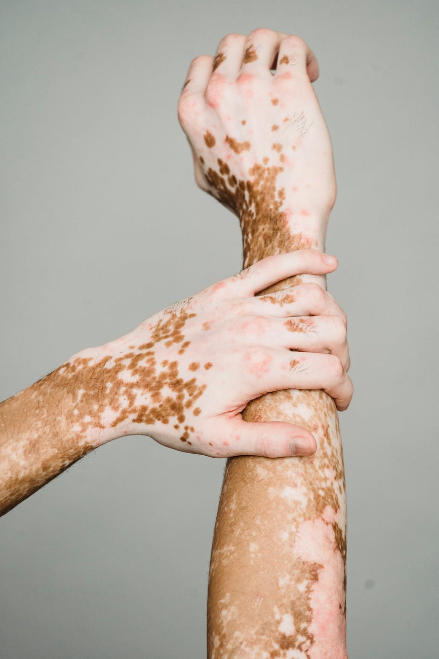 dermatologa