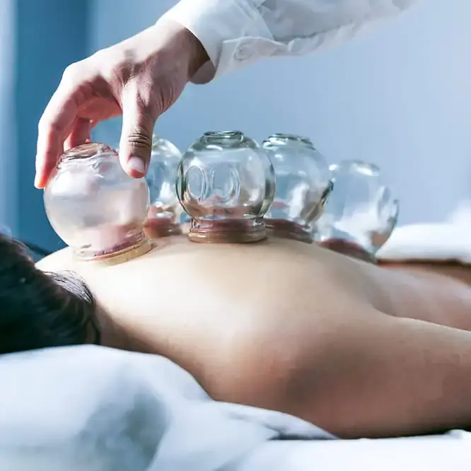 proses terapi bekam pada tubuh