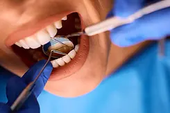 compressed_close-up-of-woman-having-her-teeth-checked-during-2026-03-16-03-28-40-utc.webp