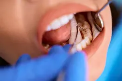 compressed_close-up-of-woman-during-teeth-check-up-at-dentist-2026-03-17-07-05-30-utc (1).