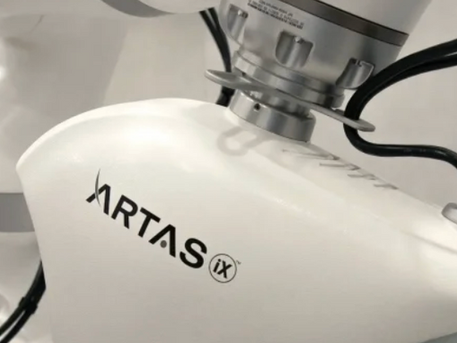 5 ways ARTAS® robotics has helped revolutionize hair transplants