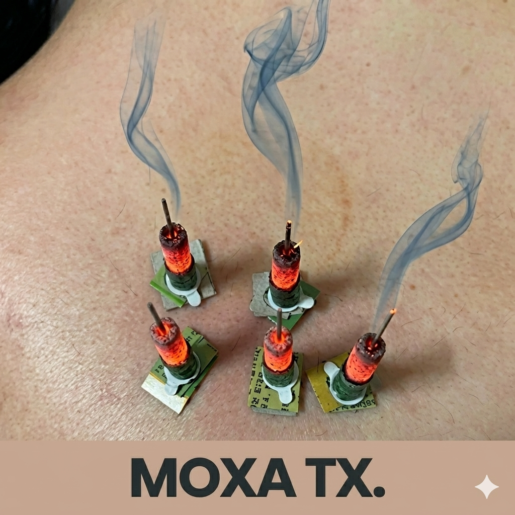 What is moxibustion(Moxa)? cover image