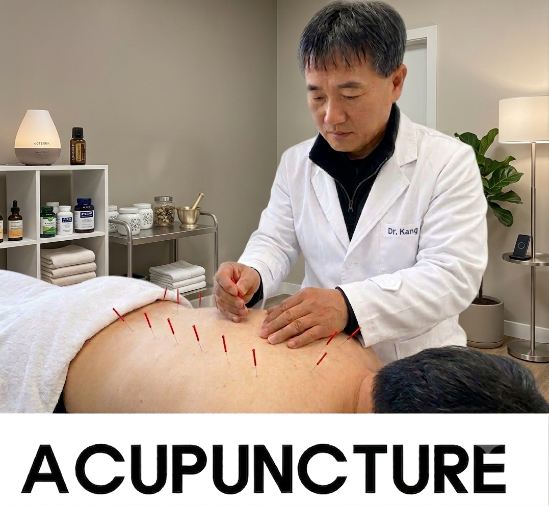 What Is Acupuncture? cover image