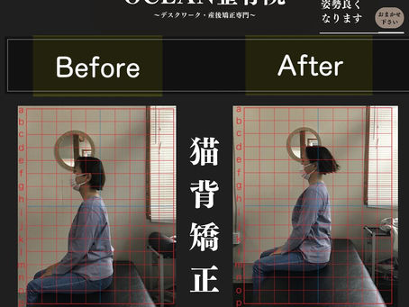 当院のOCEAN式猫背矯正は、基本的には特別なものを使っての施術や、特殊な技などを使った施術ではありませんその方その方の猫背になっている原因の筋肉や神経・関節などに対して適切にアプローチすることにより、施術終了後に患者様より、【え、今のでこんなに変わったの？！】と言われることが多々あります️特別なことをしてない分、体にも負担が少なく安心安全の施術を提供しております！痛みがなくても姿勢の治療は...
