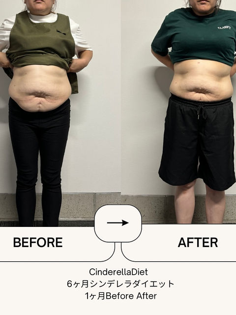 【1ヶ月経過報告Before After】6ヶ月コースのお客様の比較画像になります️1ヶ月で、体重・・・-5.1kg。体脂肪率・・・-2%ウエスト・・・-11cmヒップ・・・-4cm右太もも・・・-3cm左太もも・・・-4cm右二の腕・・・-4cm左二の腕・・・-2cmという結果でしたOCEAN整骨院ではシンデレラダイエットであなたの悩みの解決をお手伝い致します‍♂️‍♀️「結婚式までに絶対に痩せたい！」「あのころの服をもう一度着たい！」「旦那を見返したい！」「人生を変えたい！」と本気でダイエットをしたい方を徹底的に全力でサポート致します‍♀️シンデレラダイエットは、〇分子栄養学に基づく食事指導〇高品質のサプリメント〇ハイブリッドトレーニング〇遺伝子検査によるダイエットの効率化〇特殊クリームによる痩身施術この5つの柱で、理想の体重･体型を目指すダイエットとなっております。迷っているのであれば、まず初回カウンセリングを受けてみましょう‍♀️初回カウンセリングの内容は、〇食事、栄養カウンセリング〇ハイブリッドトレーニング体験〇簡易的遺伝子検査と濃い内容となっております。初回カウンセリングご希望の方は、①Instagramプロフィール欄より公式LINE追加②公式LINEで『初回カウンセリング希望』と送信③現在の体重、目標体重、目標期間、ダイエット歴も送信ください④返信が来るのを待つまた公式LINEでは、痩せる方法も無料配布中しております！是非ご利用ください。ご連絡お待ちしております‍♂️*☼*―――――*☼*―――――*☼*―――――*☼*―――――  シンデレラは報われる*☼*―――――*☼*―――――*☼*―――――*☼*―――――𓂃𓂂𓂃𓋪𓃉𓂃ํ𓂃𓂂𓂃𓋪𓂃ํ𓂃𓂂𓂃𓂂𓋪𓂃𓃉ํ𓂃𓋪𓂂𓂃ํ𓂂𓂃𓃉𓋪❏ OCEAN整骨院︎ 鹿児島県薩摩川内市五代町1857-3︎ 営業時間: 月〜金 9時〜21時　　　　　　　　土 9時〜18時　　　　　　　　日 9時〜13時︎鹿児島で姿勢矯正・産後矯正ならOCEAN整骨院︎デスクワーク・産後矯正専門#鹿児島整骨院#鹿児島整体#薩摩川内整骨院#薩摩川内整体#川内整骨院#川内整体#川内腰痛#薩摩川内腰痛#薩摩川内肩こり#川内肩こり#整骨院#整体#薩摩川内カフェ#川内カフェ#産後矯正#薩摩川内市産後矯正#川内産後矯正#川内骨盤矯正#薩摩川内市骨盤矯正 #鹿児島ダイエット #薩摩川内市ダイエット #整骨院ダイエット #ダイエット #川内ダイエット #シンデレラダイエット #シンデレラは報われる #薩摩川内市カフェ #川内カフェ #OCEAN整骨院 #薩摩川内市産後矯正 #川内産後矯正𓂃𓂂𓋪𓂃𓂂𓂃𓋪𓃉𓂃ํ𓂃𓂂𓂃𓋪𓂃ํ𓂃𓂂𓂃𓂂𓋪𓂃𓃉ํ𓂃𓋪𓂂𓂃ํ𓂂𓂃𓃉𓋪