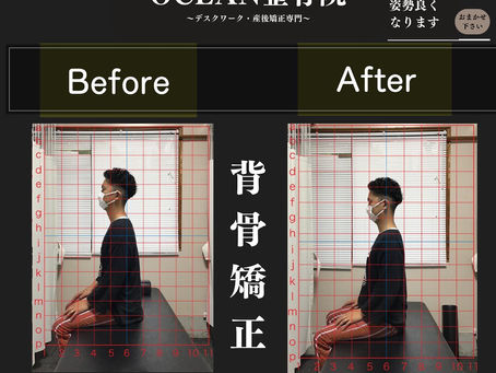 こんにちは！OCEAN整骨院です!当院で1番人気の背骨矯正です🦴「ボキッ」って音は怖い方も多いとは思いますが、基本的には全く痛くありません️どうしても怖くて力が入ってしまうと痛みを伴ってしまいます。