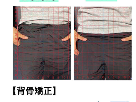 こんにちは️OCEAN整骨院です！当院で1番人気の背骨矯正です?「ボキッ」って音は怖い方も多いとは思いますが、基本的には全く痛くありません️どうしても怖くて力が入ってしまうと痛みを伴ってしまいます。