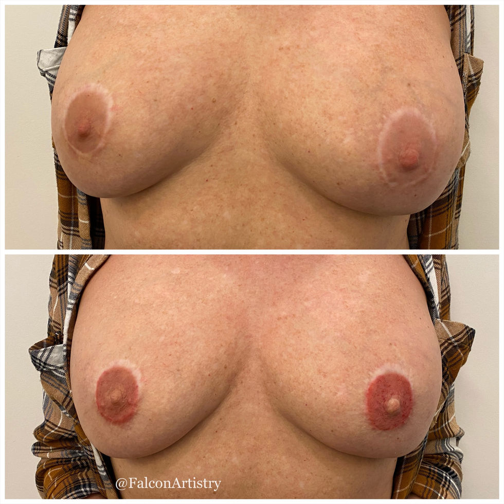 3D nipple tattoo with soft shading to achieve a lifelike, dimensional result.