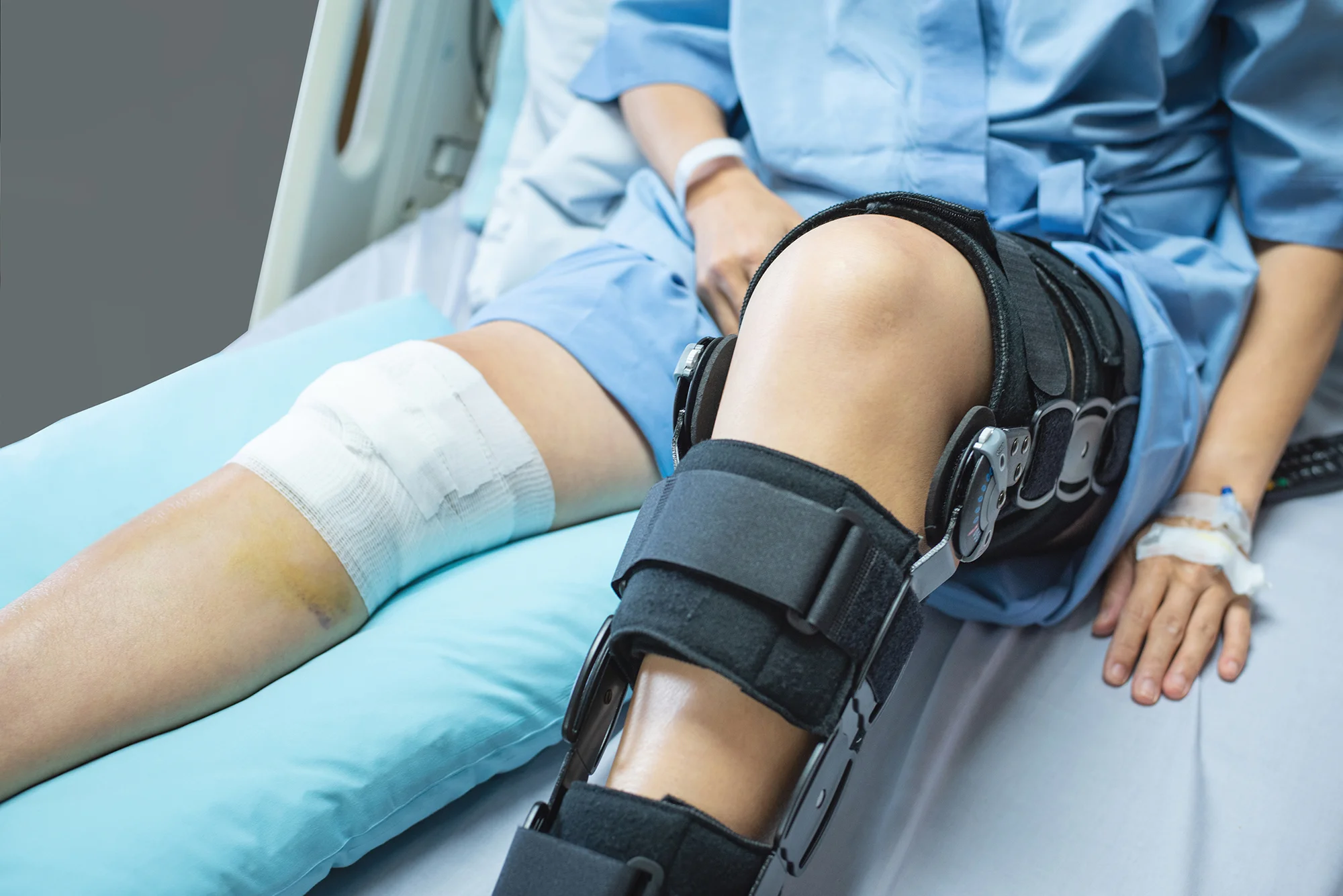 asian-woman-patient-with-bandage-compression-knee-brace-support-injury-on-the-bed-in-nursi