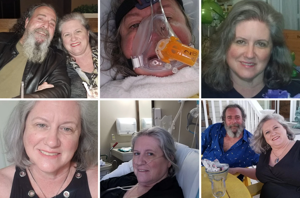 Lori Robinette, 58, Bloxom, VA, Anti-vaxxer, Almost 2 Months Hospitalized with Covid