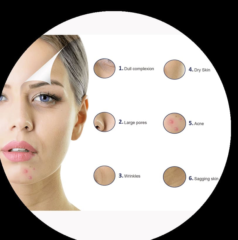 Thumbnail: HI SKIN | Skin Activation