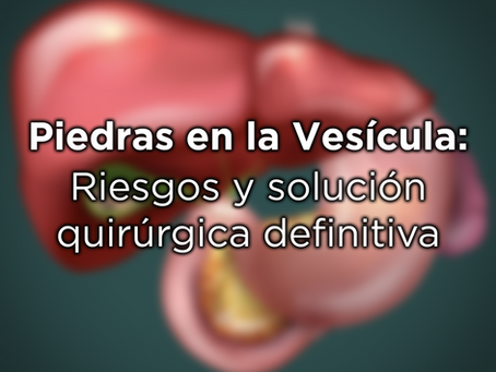 Piedras en la Vesícula: Riesgos y solución quirúrgica definitiva