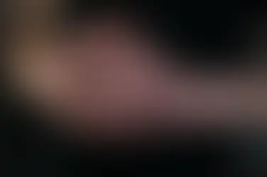 Jednorázové rukavice pro alergiky. Co skutečně vyvolává alergii a jak vybrat