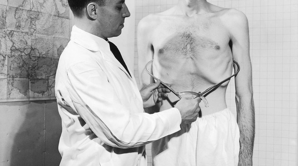 Historical black and white photo from the 1940s Minnesota Starvation Experiment. A researcher in a lab coat measures the waist of a severely emaciated man using calipers, clearly showing the extreme effects of prolonged calorie restriction.