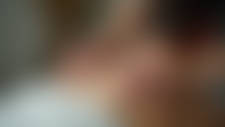 Explore Benefits of Cupping Therapy at Lotus Path