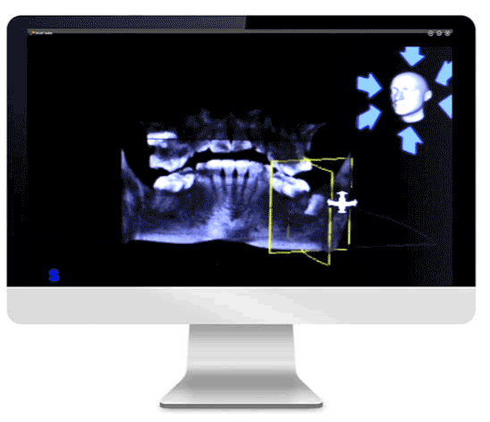 dental-implants-technology.gif