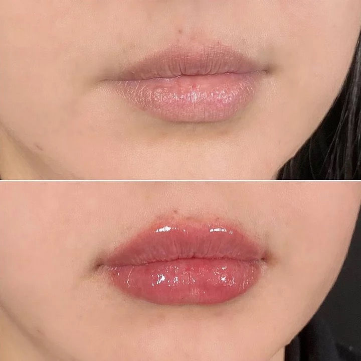 Thumbnail: LIP PLUMPER PEN