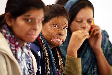 Acid-Attack-Victims-Can-Now-Get-Free-Treatment-In-Delhi.jpeg