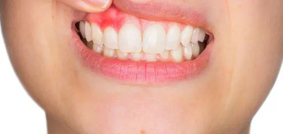 Dis Klinigi Mydentalclinictr Cankaya Mustafa Kemal Mahallesi