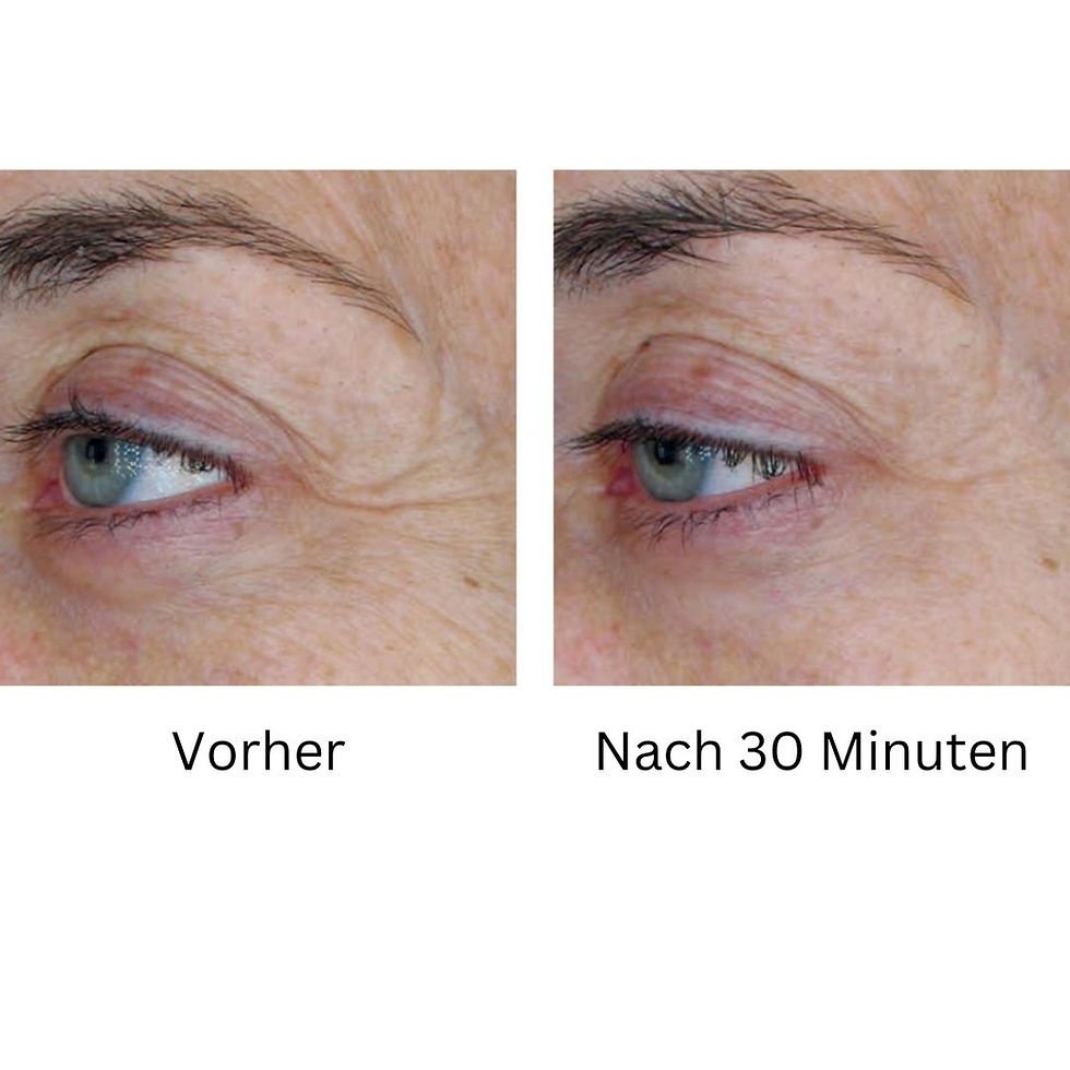 Miniaturbild: FRESH IT UP – Serum