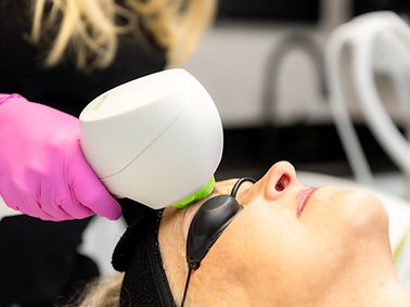 The-Laser-Room-IPL-2835-1024x682.jpg