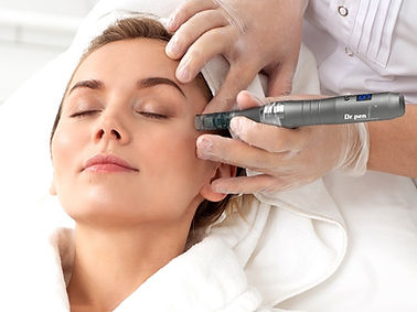 dermapen-facial.jpg