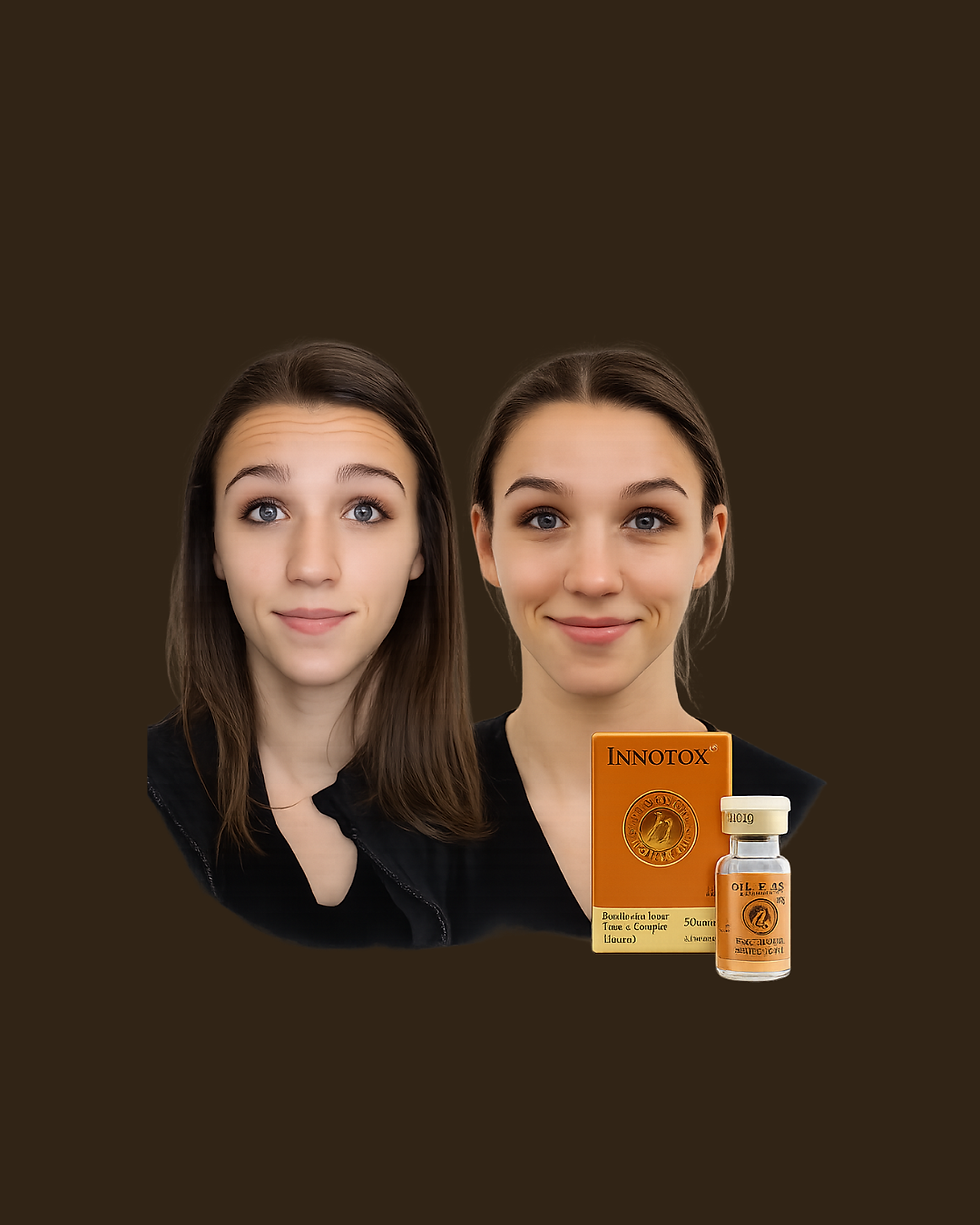 Miniatura: Baby Botox Toxina Botulinica 50 uds. Resultados naturales y Preventivos