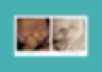 4D Ultrasound Before and After