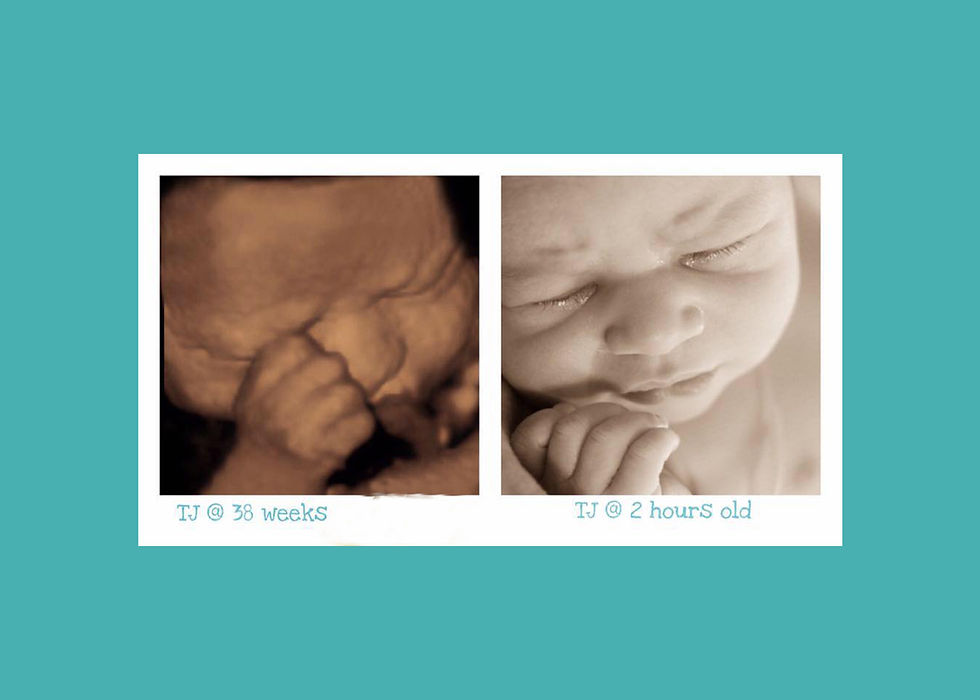 4D Ultrasound Before and After