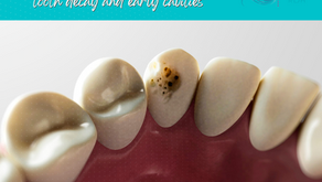 How to reverse tooth decay and early cavities