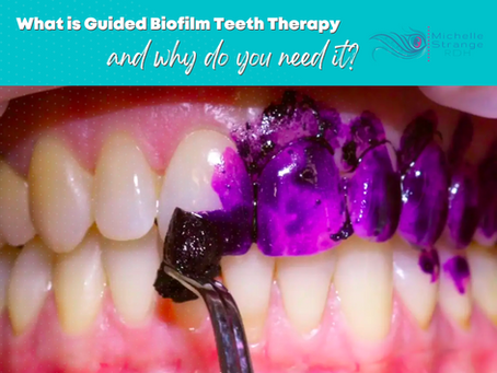 What is Guided Biofilm Teeth Therapy and why do you need it?