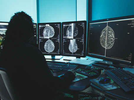 Mammography