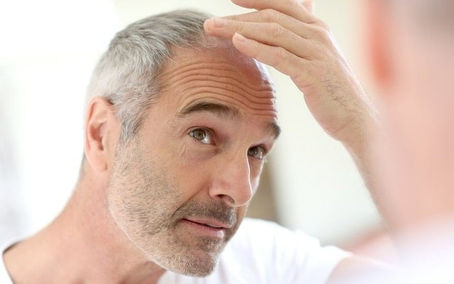 Diabetes and Hair Loss: The Hidden Link and How to Restore Wellness Naturally