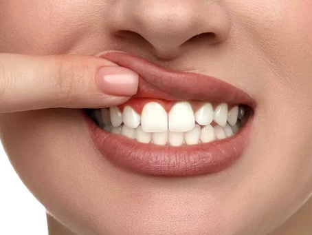 What to Expect Before, During, and After Gum Contouring