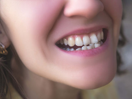 Crooked Teeth in Kids: How Early Treatment Can Lead to a Lifetime of Confidence