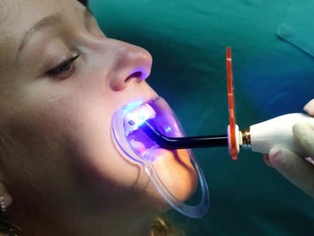 Orthodontists Discuss the Long-Term Benefits of Correcting Your Bite