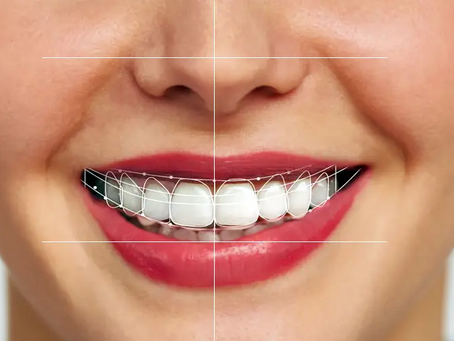 The Role of Artificial Intelligence in Digital Smile Design
