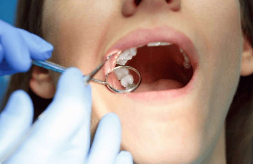 The Pros and Cons of Wisdom Tooth Extraction