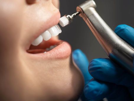Top 10 Benefits of Regular Teeth Cleaning for Your Oral Health
